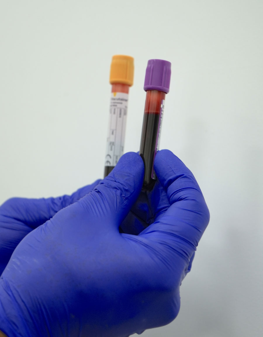 Regenifi Blood Test Clinic